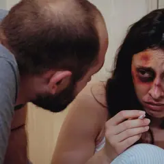 Mąż wykańcza mnie psychicznie. Widać siniaki na twarzy kobiety, która trzyma papierosa.